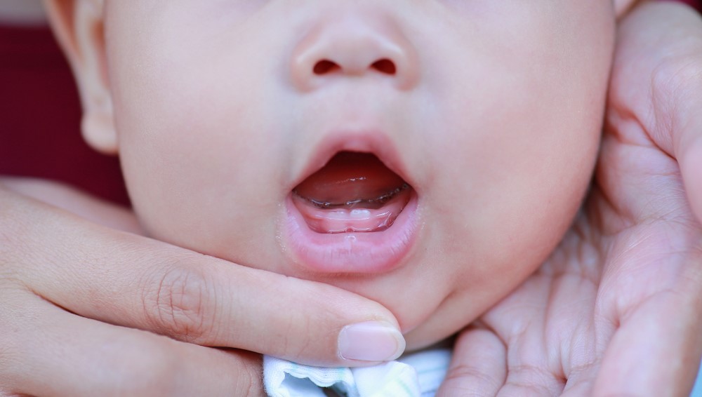 Τα πρώτα δόντια του μωρού (οδοντοφυΐα) ΔΕΝ προκαλούν πυρετό